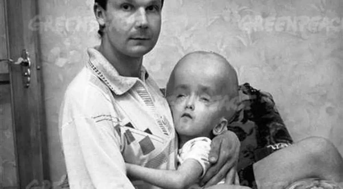 Amintirea neagră a dezastrului nuclear. Vezi câţi dintre locuitorii Belarusului suferă şi acum din cauza exploziei de la Cernobîl