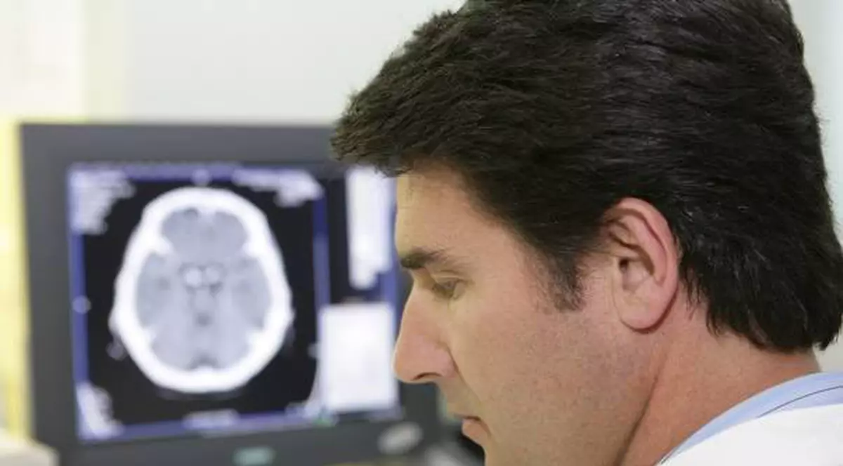 Surprinzător! Opiniile politice sunt vizibile în creier