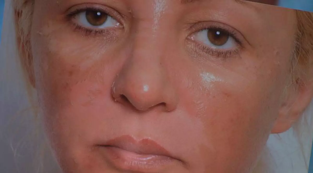 Tratament de coșmar la un salon din Râmnicu Sărat: Arsă la solar! | FOTO