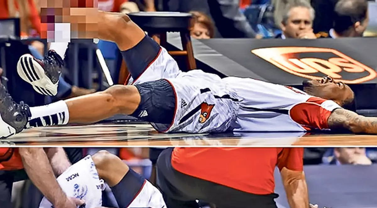 Baschetbalistul american Kevin Ware a suferit o accidentare groaznică la picior | VIDEO