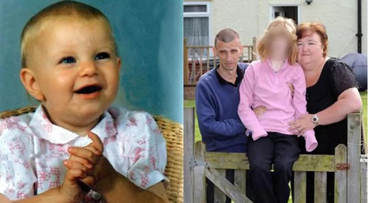 POZE ŞOCANTE: Povestea fetiţei arse în proporţie de 90%. Impresionat!