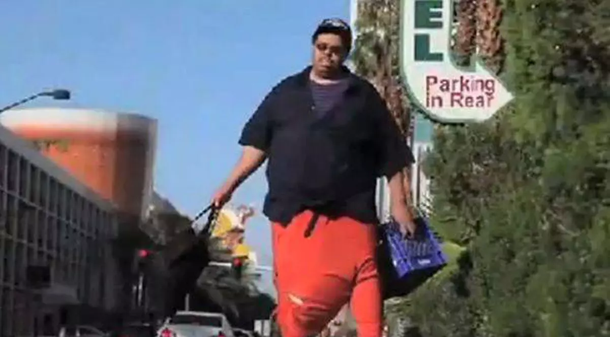 Bărbatul cu cel mai mare scrot din lume, de 45 de kilograme, s-a operat! | VIDEO