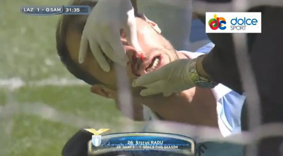 Radu Ștefan, făcut KO în meciul Lazio - Sampdoria! VIDEO
