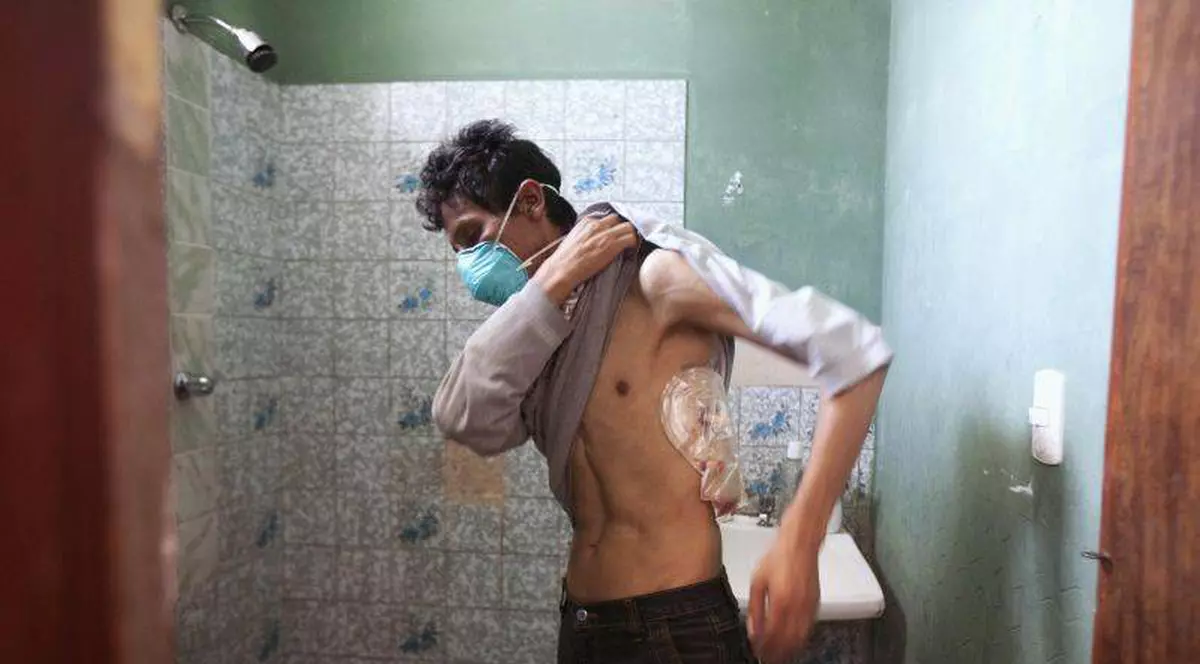 Alertă de TBC în Bucureşti, Ilfov şi Giurgiu DSP şi IŞJ Ilfov ascund gunoiul sub preş 