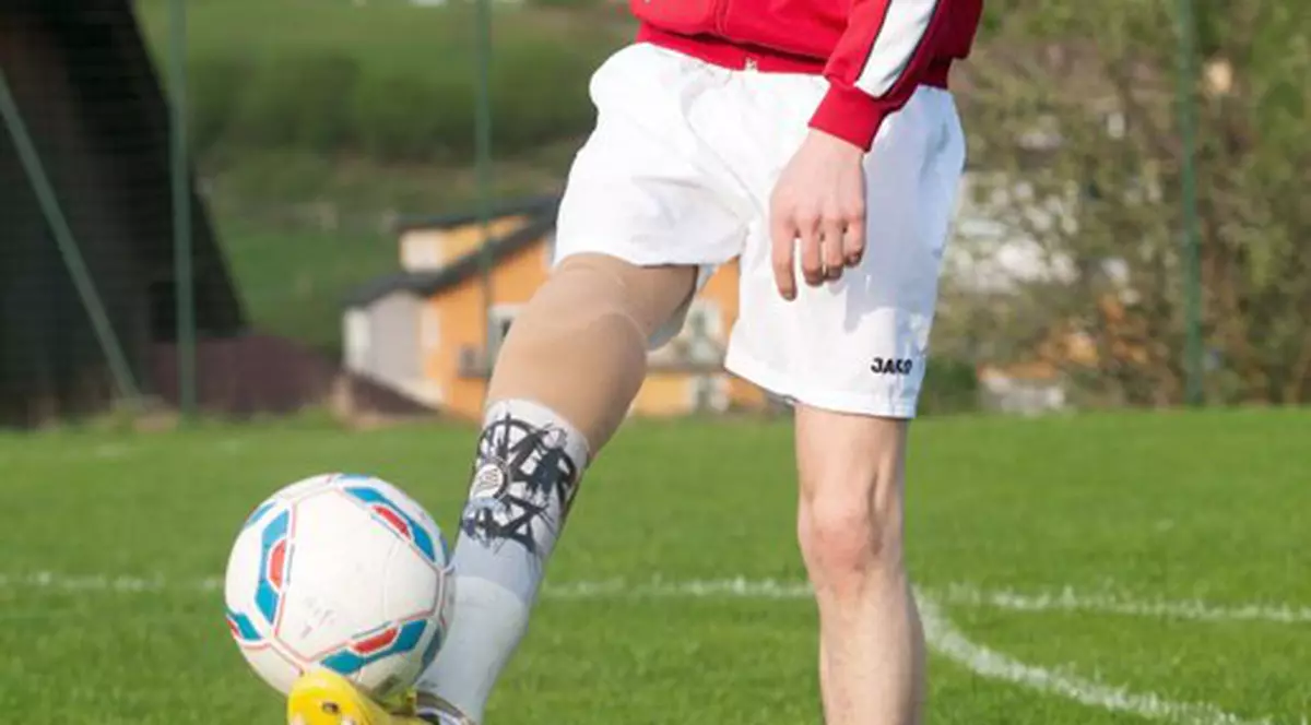 Martin Hofbauer, fotbalistul cu un picior de carbon