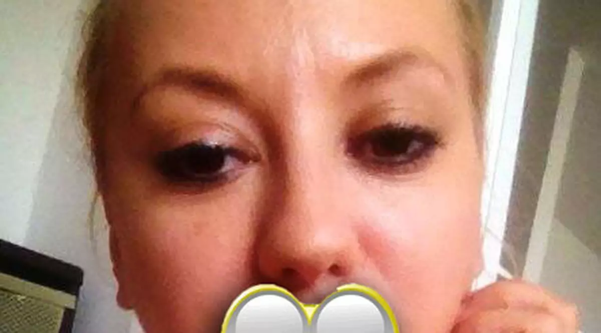 Larisa ex-Drăgulescu și-a injectat acid hialuronic. Uite cum arată! FOTO 