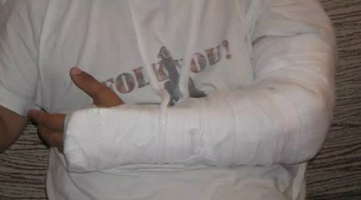 ŞI-A ANULAT CONCERTELE! Un solist român şi-a rupt mâna!