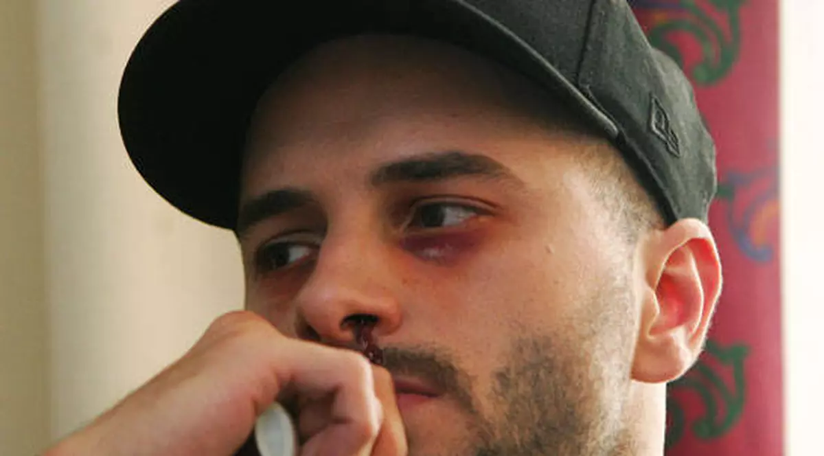 Uzzi, celebrul component al trupei BUG Mafia, şi-a terminat TATUAJUL CARE ÎI ACOPERĂ TOT SPATELE DUPĂ DOUĂ LUNI. Vezi CUM arată! VIDEO 