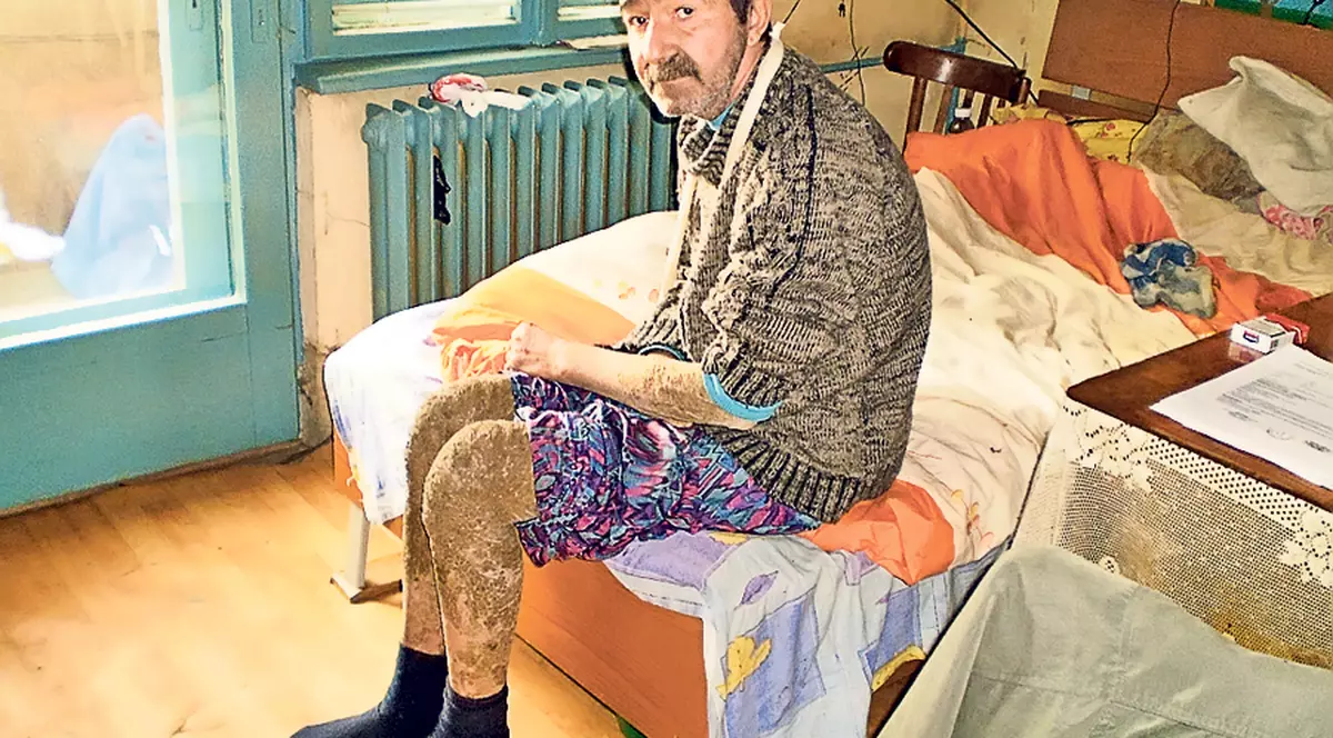 «Omul-şopârlă» a băut clor ca să se omoare