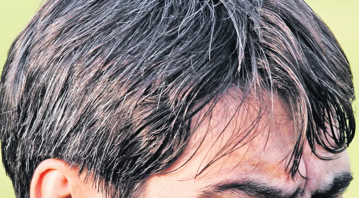 I-a scos peri albi | Presiunea meciurilor cu Ungaria și Turcia și-a pus amprenta în mod vizibil asupra lui Victor Pițurcă