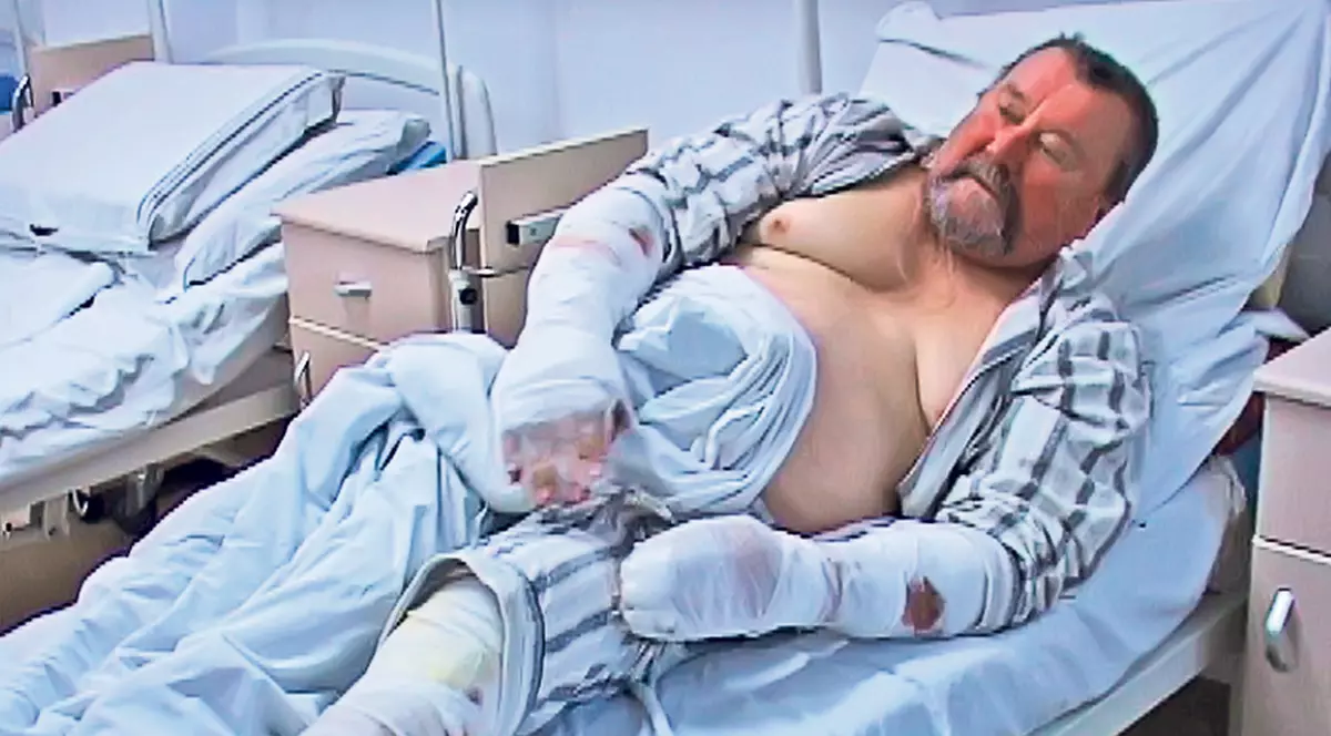 Vasluian atacat de 14 maidanezi, salvat de patrupedele lui: «A fost un accident, eu tot iubesc câinii»