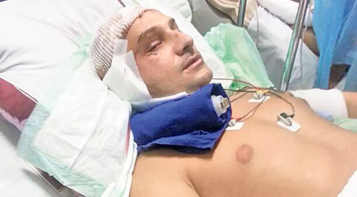 Desfigurat de la o şaorma! Un tânăr din Bucureşti e în stare gravă la spital în urma unui scandal