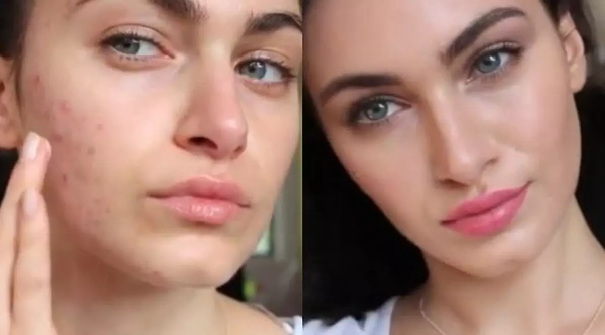 Cum să te machiezi ca să ascunzi coşurile! Video spectaculos!