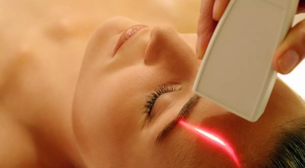 Cearcănele și umbrele întunecate din jurul ochilor pot dispărea cu un laser special