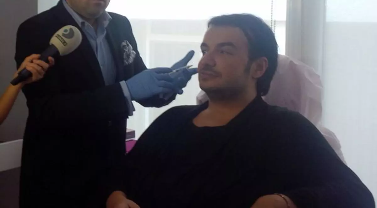 Răzvan Ciobanu şi-a injectat Botox în frunte