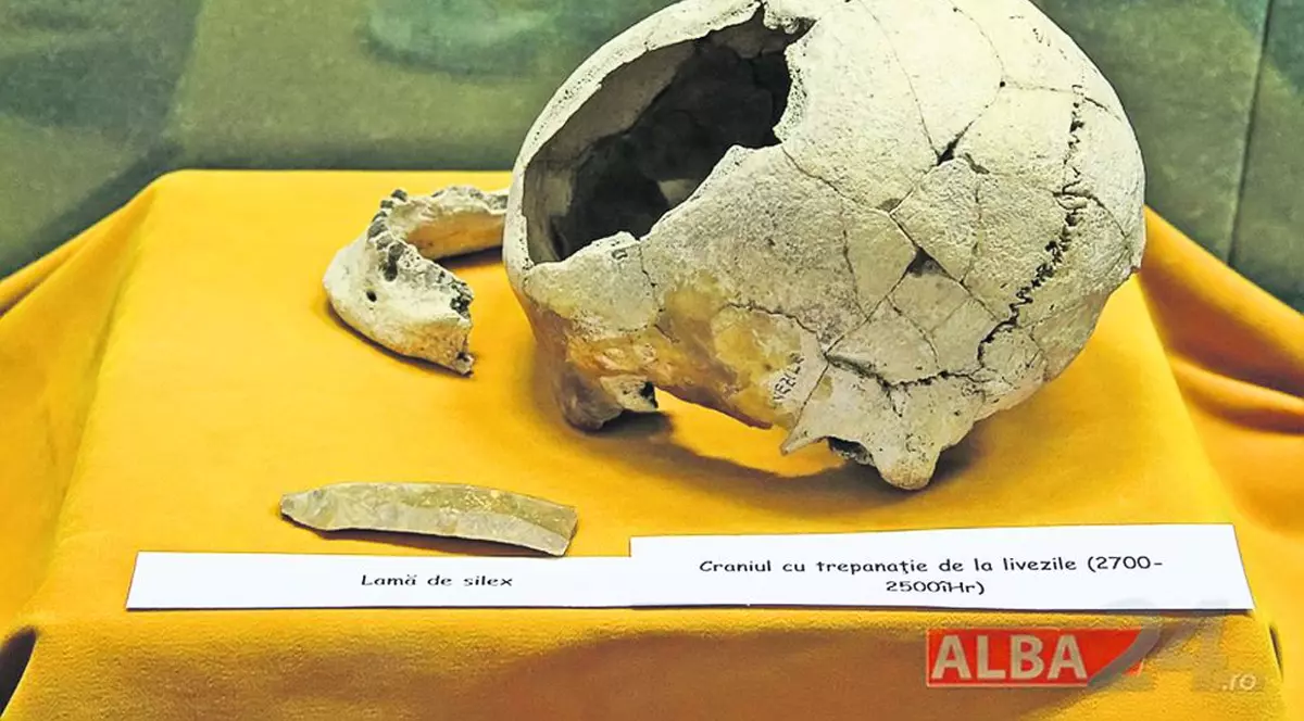 Operaţii pe creier acum 4.500 de ani, la Alba