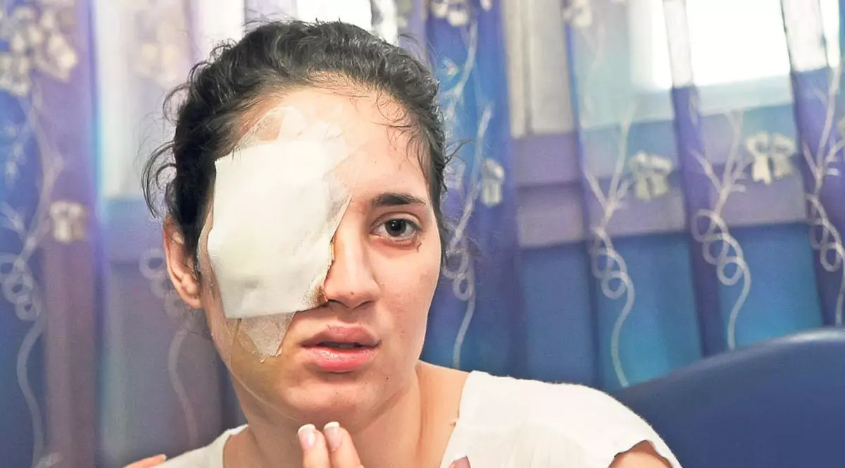 Fata împuşcată în ochi cere daune de 1.000.000 €