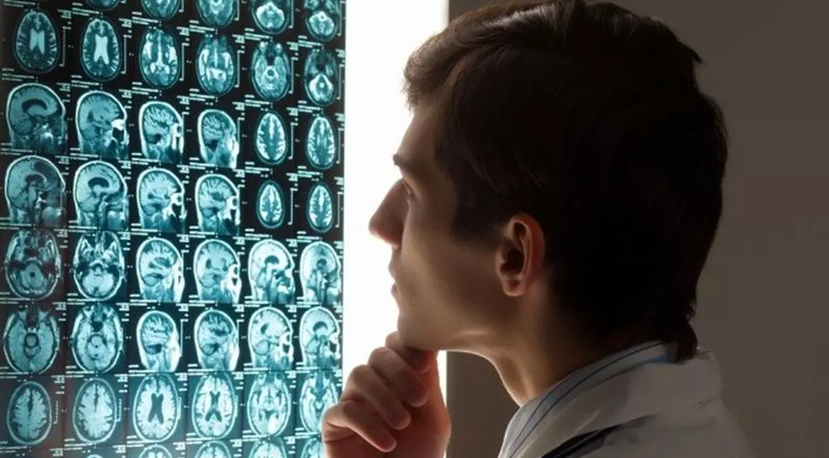 Cancerul cerebral: Care sunt simptomele unei tumori pe creier