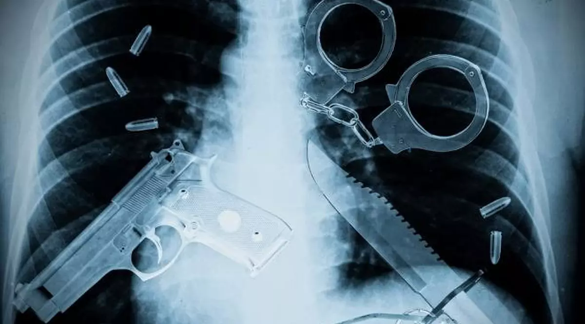 Scârbos: Top 4 obiecte ciudate ascunse în anus. Uite ce au găsit doctorii