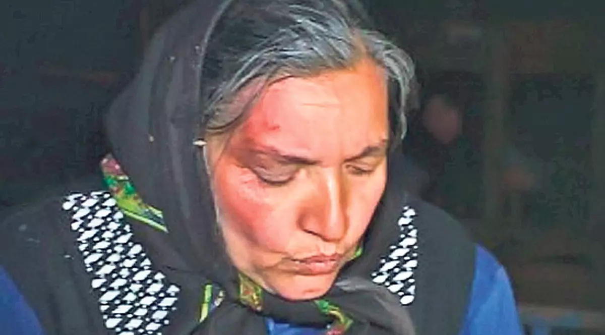 Şi-a spart capul, la coadă la agheasmă