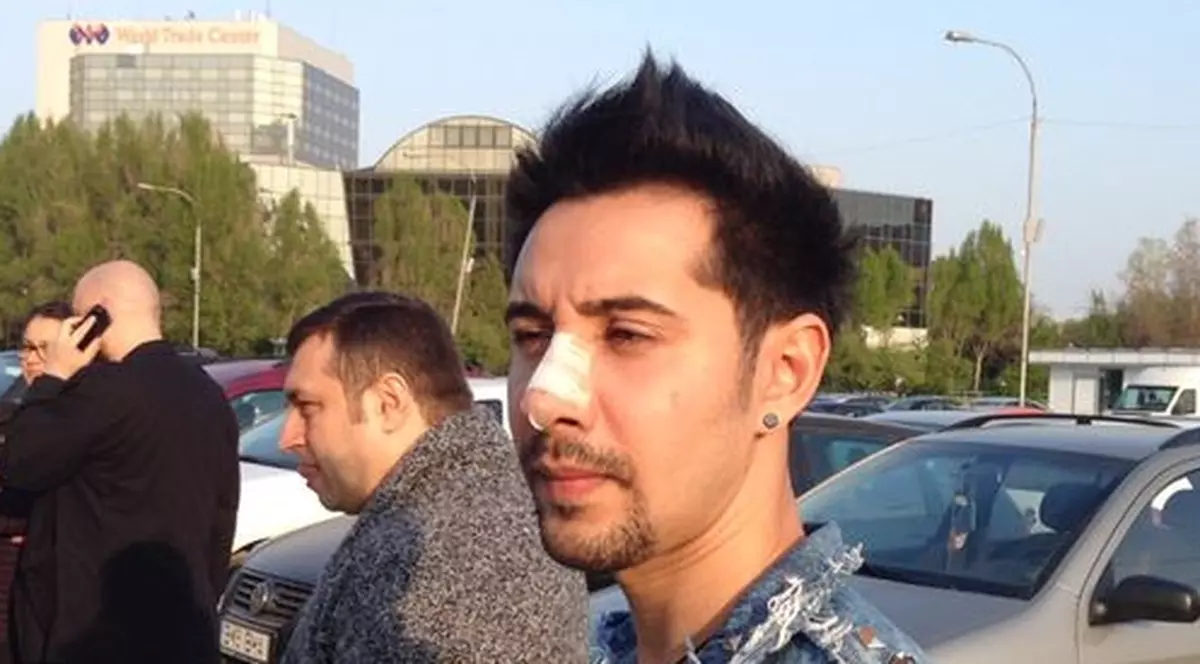 Adi Cristescu a apărut la ZU Music Awards CU NASUL PANSAT