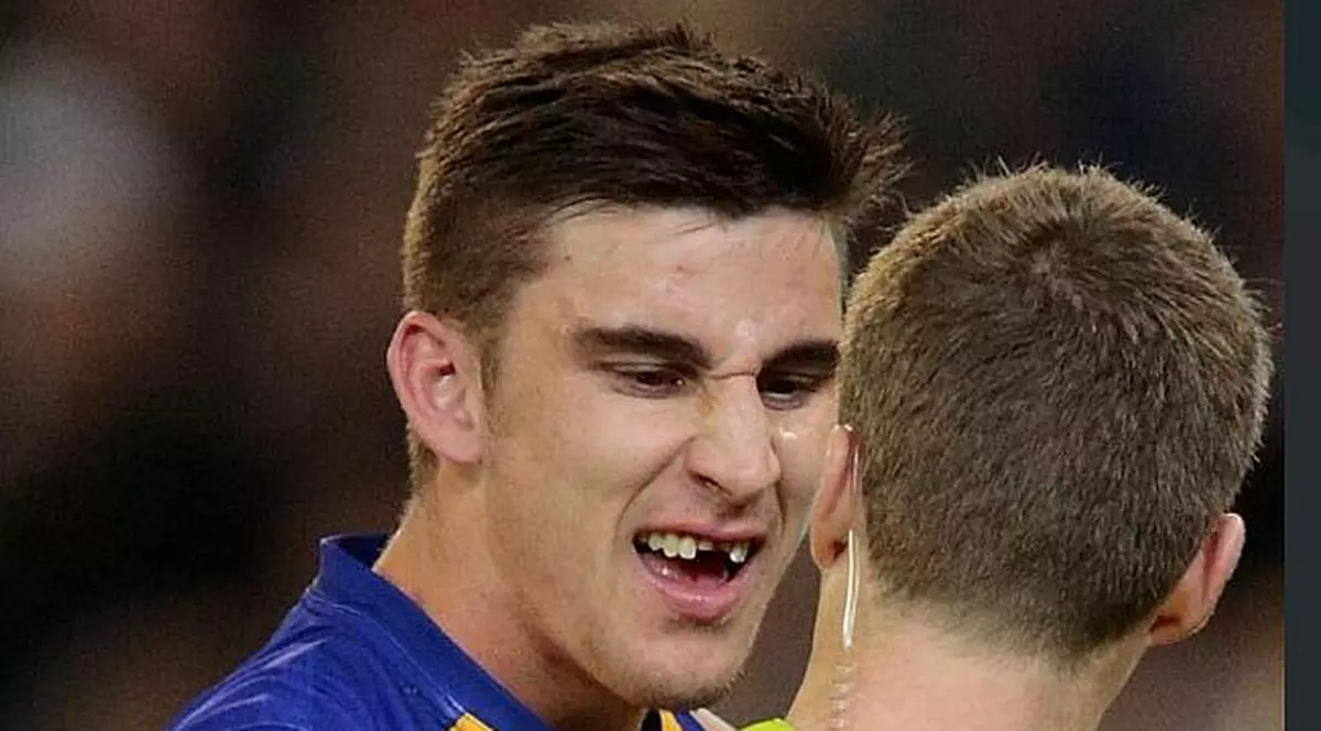 Adio, dantură! A pierdut doi dinți pe gazon