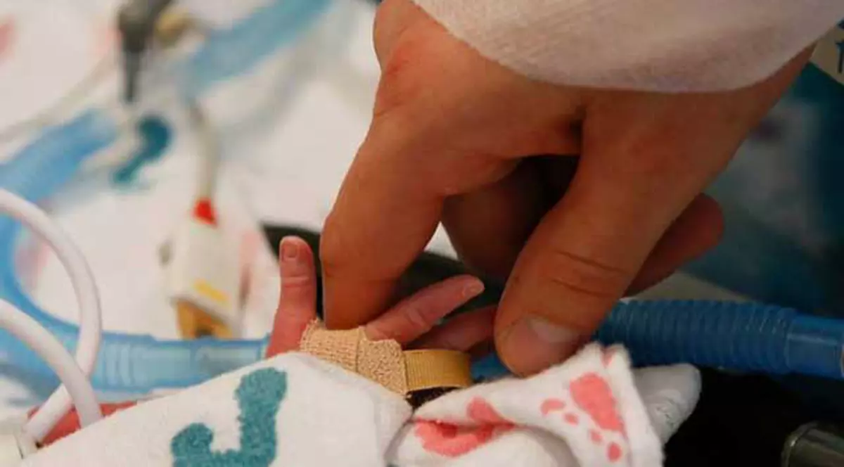 IMAGINEA CARE A CUCERIT INTERNETUL! Gemenele care S-AU NĂSCUT ŢINÂNDU-SE DE MÂNĂ | FOTO