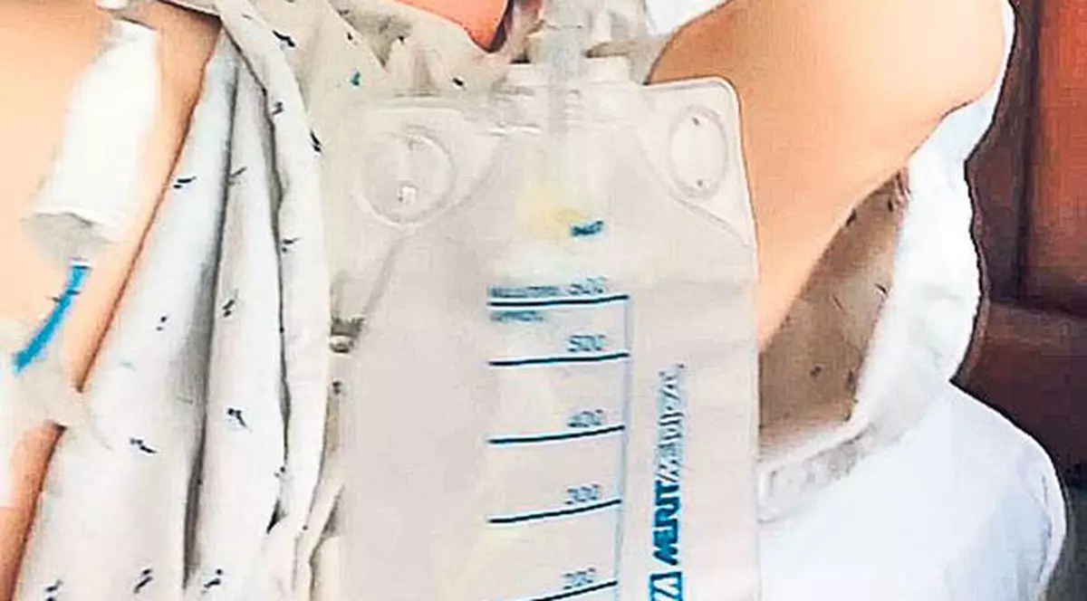 E căutat de Interpol pentru că nu s-a întors din SUA după operaţie