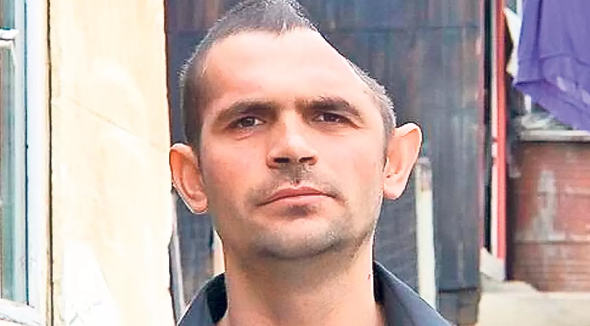 A trăit 11 luni fără jumătate de craniu