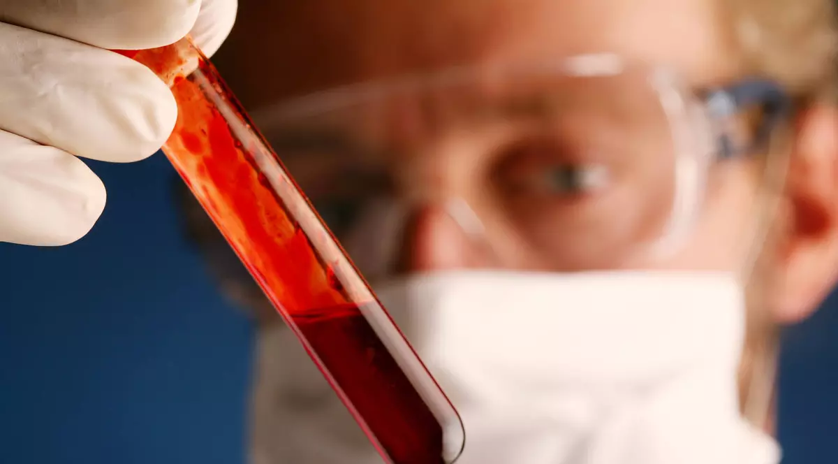 PREMIERĂ MEDICALĂ. Analiza care DEPISTEAZĂ RISCUL TRANSMITERII CANCERULUI în familie 