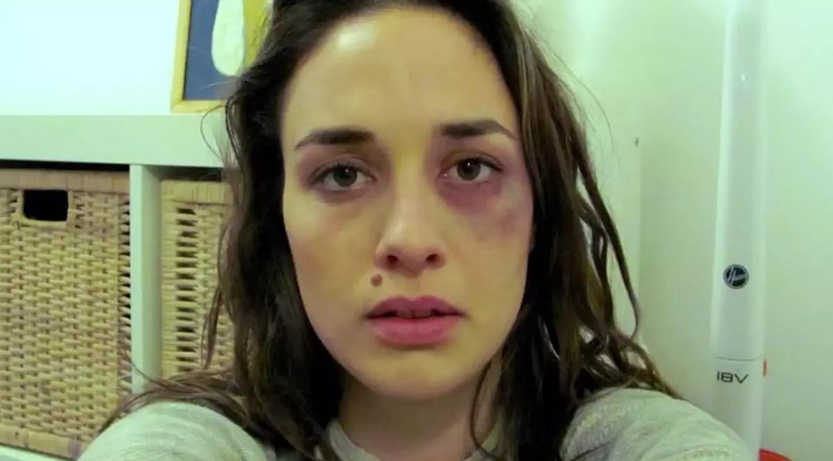 O TÂNĂRĂ şi-a făcut POZE, ZILNIC, timp de un an. FINALUL este DRAMATIC | VIDEO