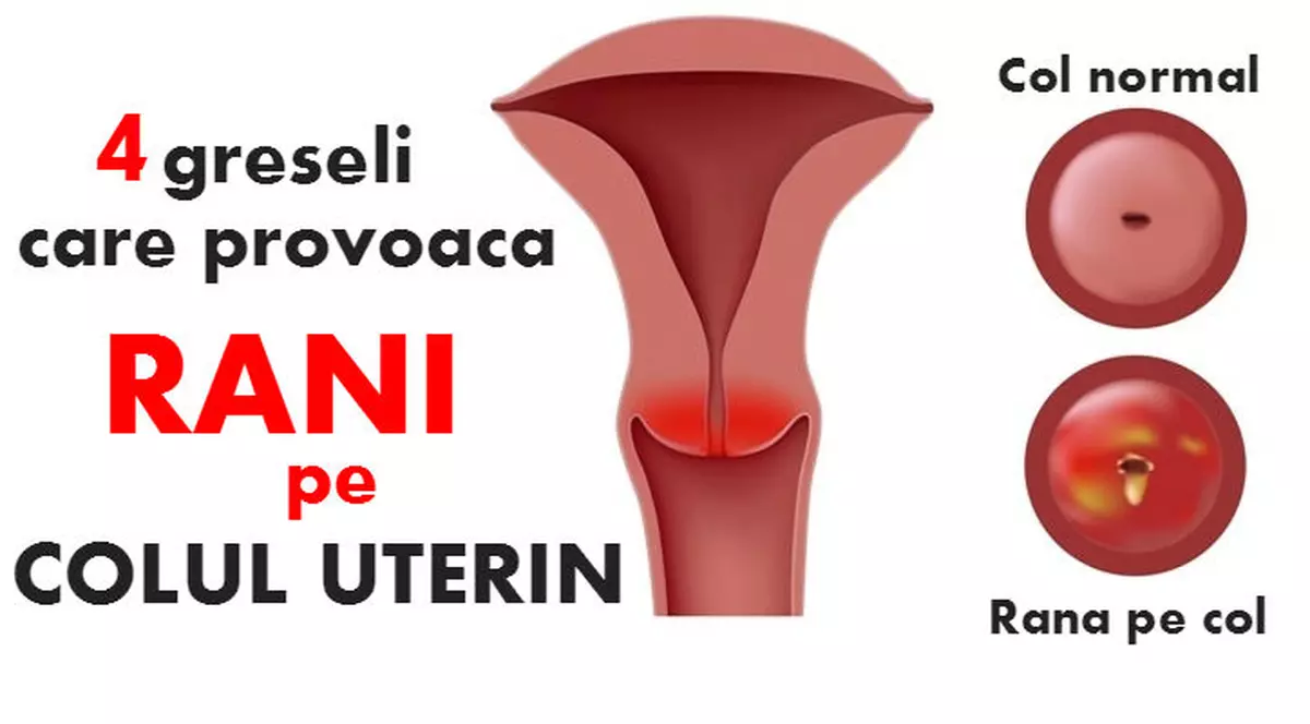 4 greşeli care provoacă răni pe col