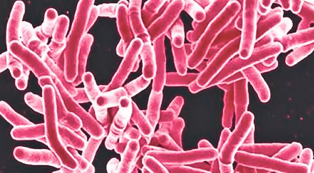 Tuberculoza ucide tot mai mulţi oameni