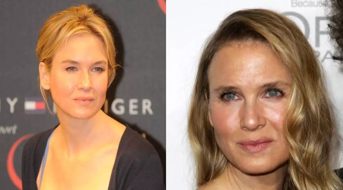 CUM EXPLICĂ actriţa Renee Zellweger SCHIMBAREA ULUITOARE a ÎNFĂŢIŞĂRII | FOTO