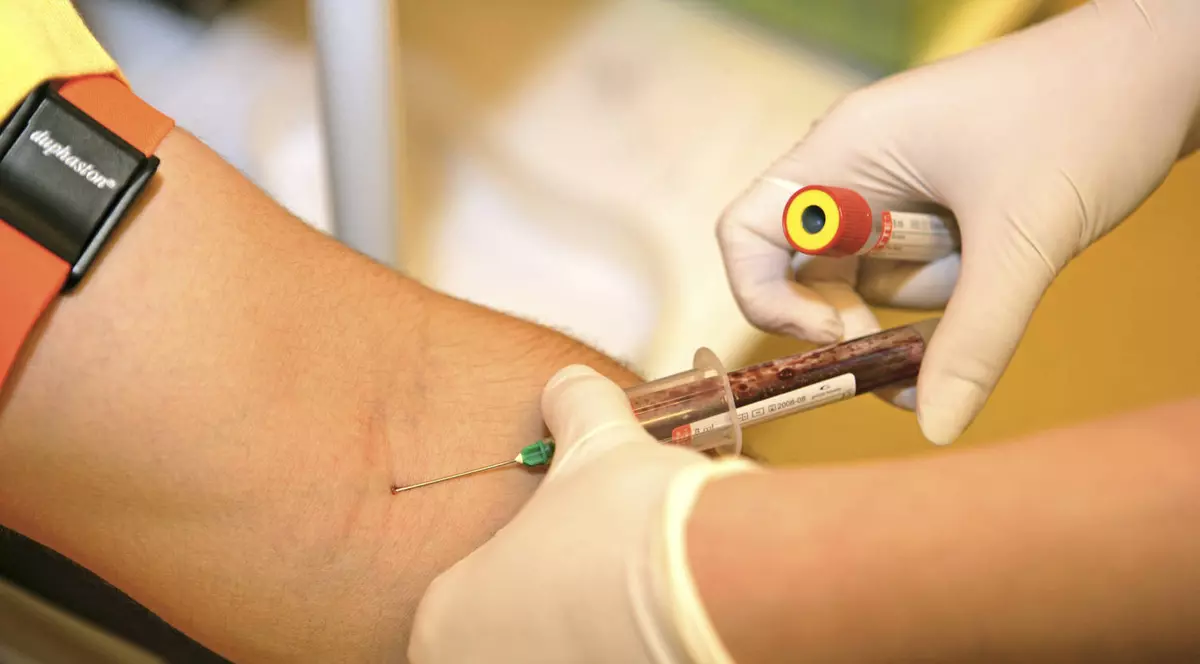 Un tânăr din Segarcea, suspectat că a infectat cu HIV zeci de persoane 