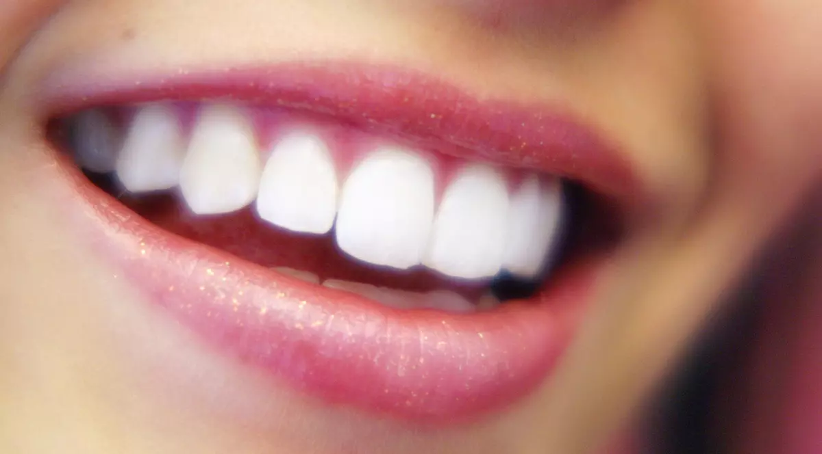 UIMITOR cât de SIMPLU E! Cum îți ALBEȘTI DINȚII GARANTAT, în doar 3 MINUTE, cu ingrediente pe care le ai în casă | VIDEO