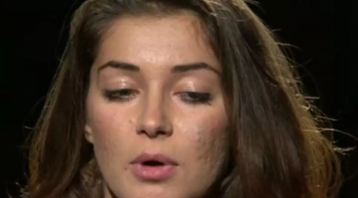 Ai coșuri în exces? Un ingredient din bucătărie te ajută să scapi de ele