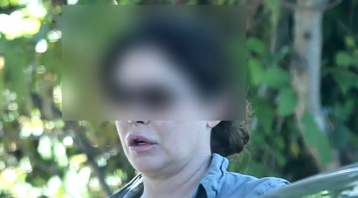 BOTOXUL A NENOROCIT-O! ÎN CE HAL A AJUNS SĂ ARATE FAŢA UNEI SUPERBE ACTRIŢE? FOTO