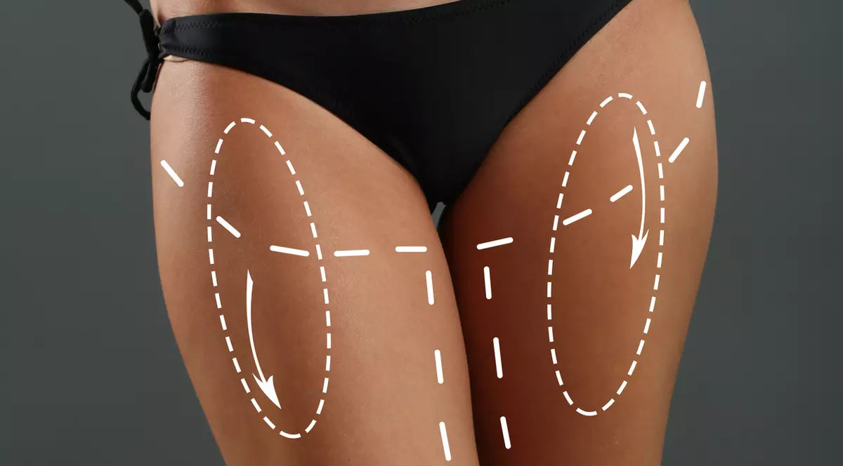 LIPOSUCŢIA ALIMENTARĂ. Tratamentul care schimbă tot ceea ce (am crezut că) ştim despre nutriţie