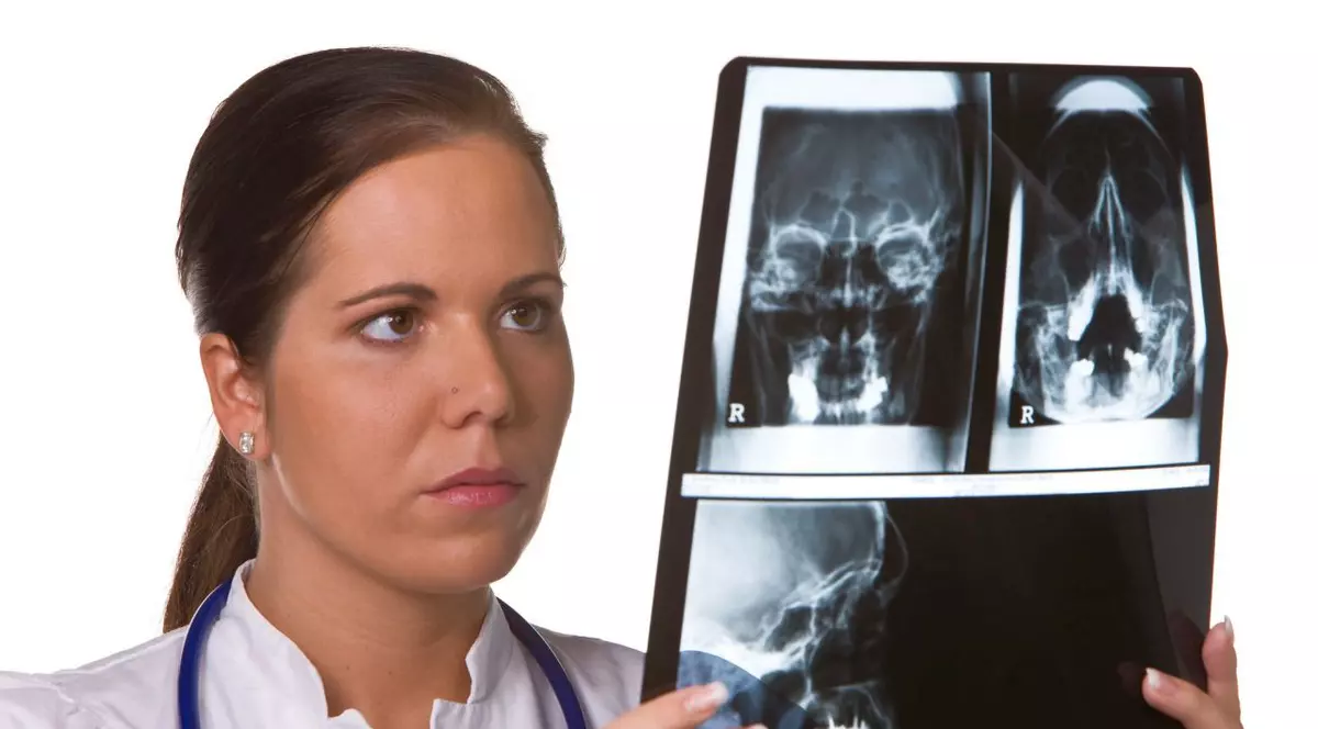 Se plângea de dureri de cap și pierderi de memorie! Doctorii au fost ȘOCAȚI de ce au găsit în creierul unui bărbat, după 4 ani investigații medicale