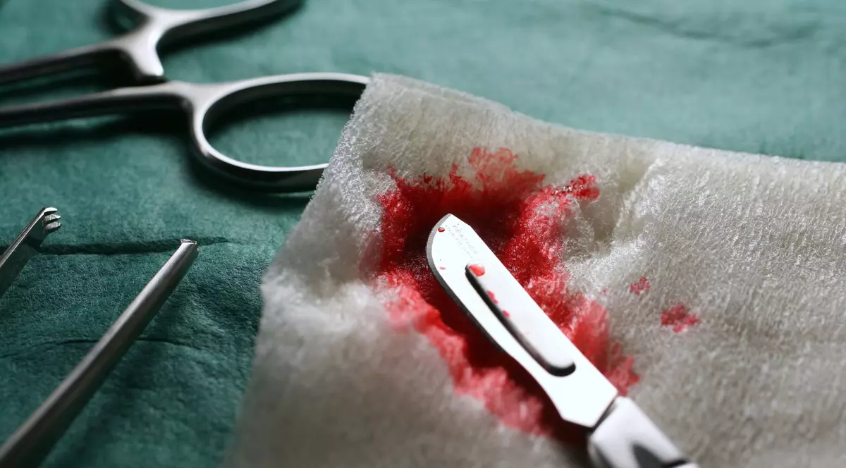 Medicul militar, ACUZAT de luare de MITĂ. Ar fi CERUT 1000 de euro pentru o OPERAȚIE