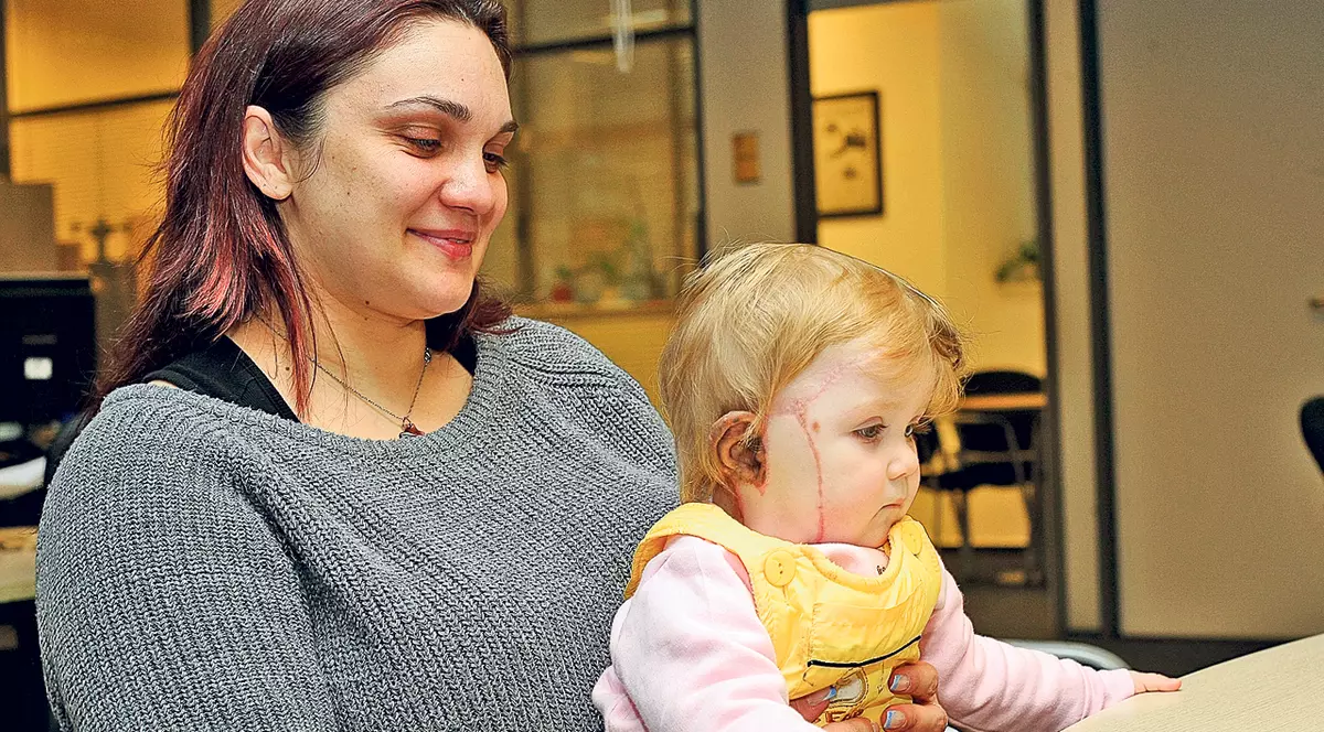 Teo ne-a vizitat la redacţie! Micuţa cu nev congenital mai are nevoie de 5.500 € pentru operaţia din SUA