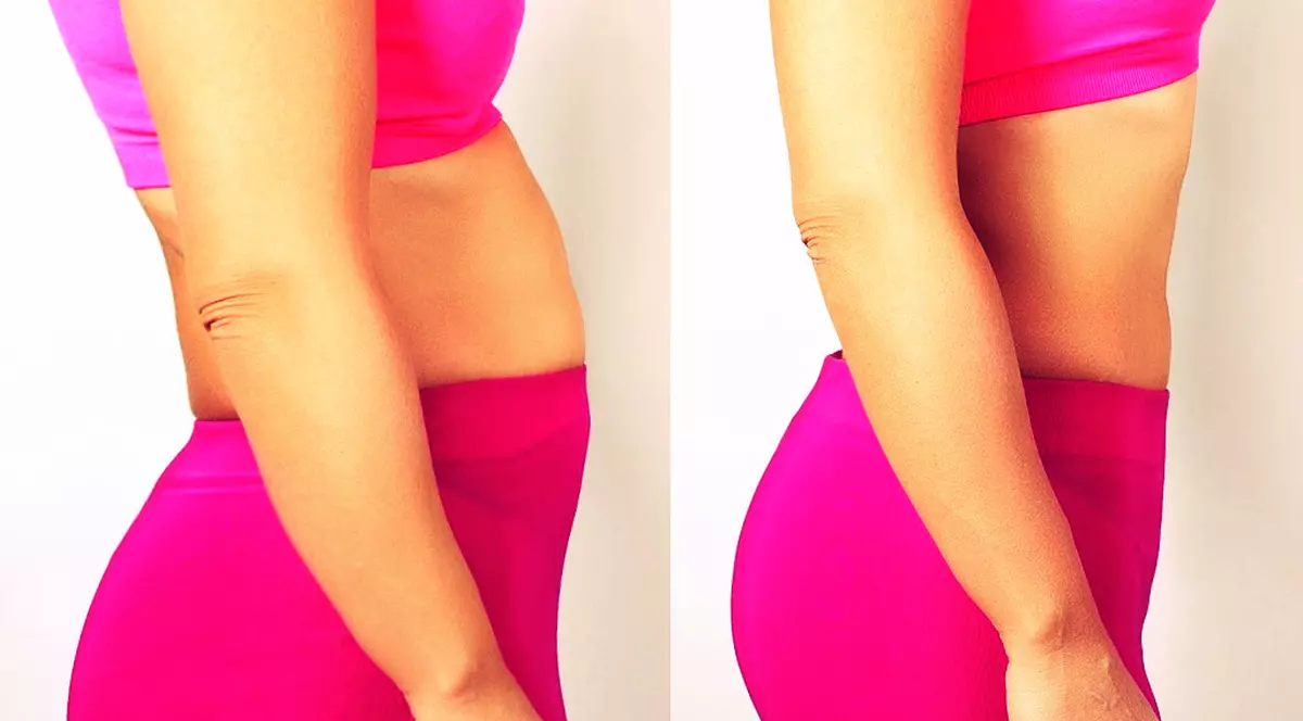 Greşeli care provoacă balonare