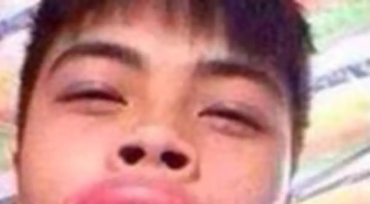 Metoda ”broasca țestoasă”, pentru buze imense fără operații estetice! FOTO ȘOCANT