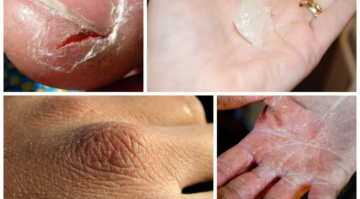 CREMA MAGICĂ DE MÂINI PENTRU IARNĂ. O POŢI FACE ACASĂ!
