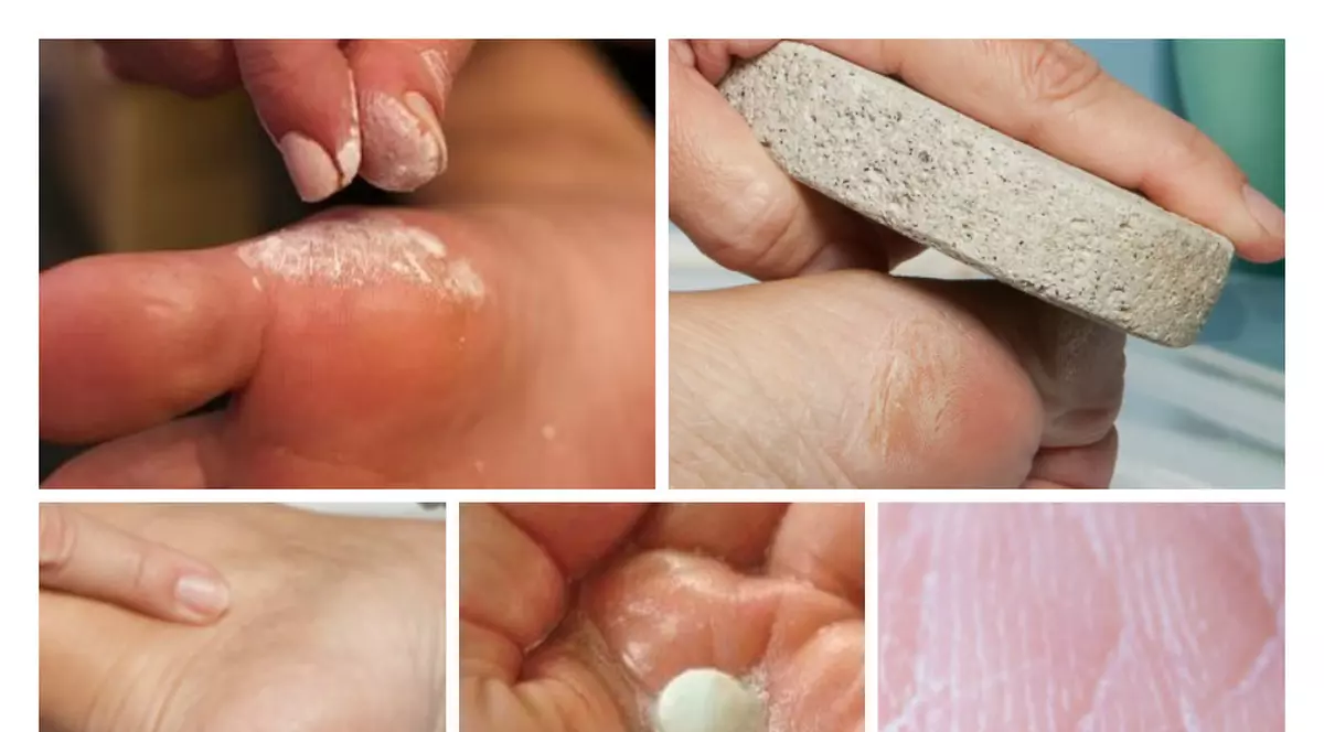 5 moduri în care poți folosi aspirina