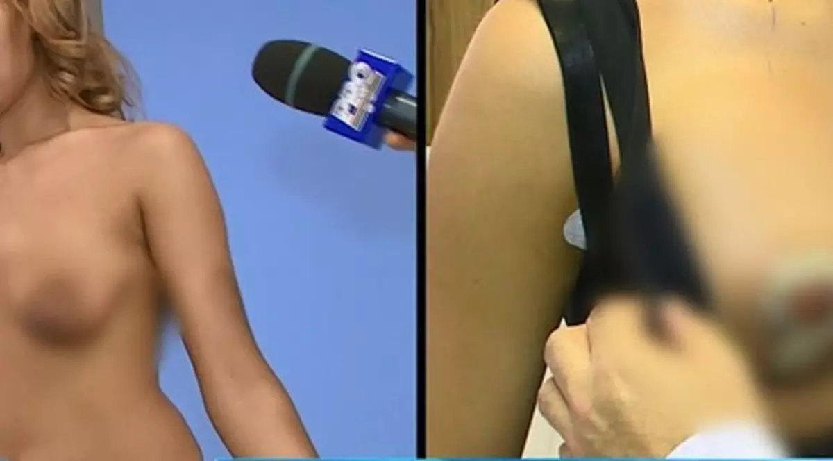 PRIMELE IMAGINI cu BEYONCE de ROMÂNIA, după operații. UITE CUM ARATĂ SÂNII și FUNDUL ei | FOTO