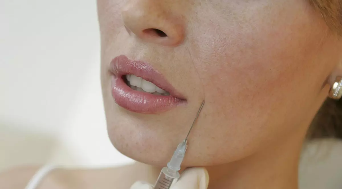 Avocată din Alba Iulia, desfigurată după o intervenție estetică! Ce i-a injectat medicul, în loc de botox? FOTO ȘOCANT