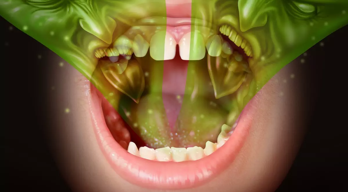 5 metode rapide să scapi de respirația urât mirositoare