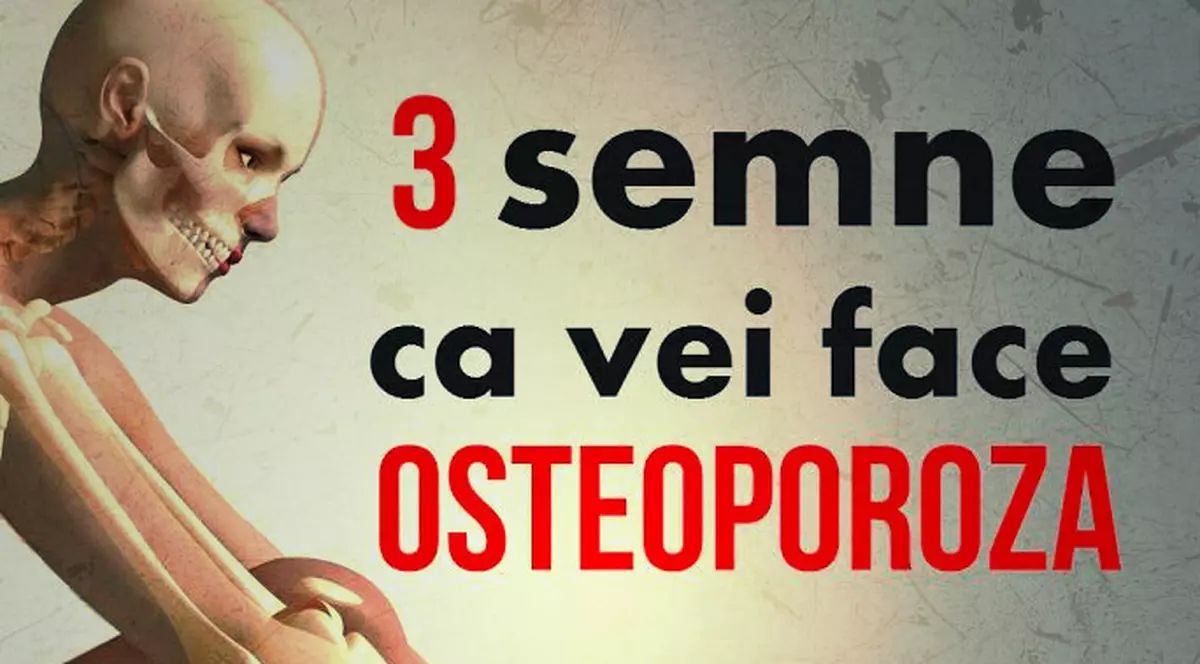 Semne că vei face osteoporoză